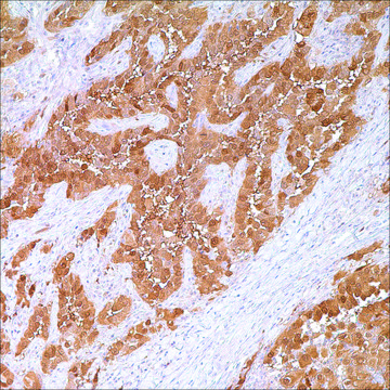 Calretinin Rabbit Polyclonal Antibody