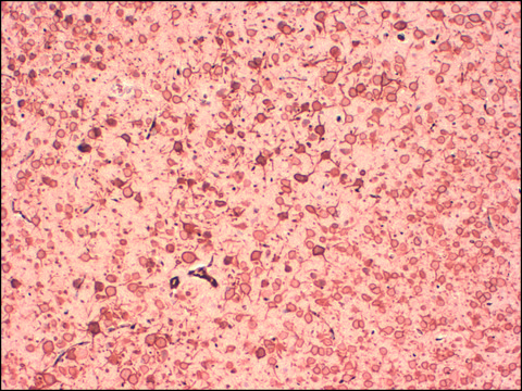 Monoclonal Anti-KCNB1 antibody produced in mouse clone S4-11, 1&#160;mg/mL, purified immunoglobulin