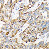 Anti-Cytokeratin 16 (KRT16) Antibody, clone 8L6R4, Rabbit Monoclonal