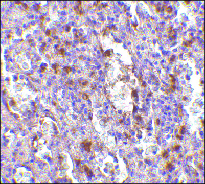 Anti-ORAI1 antibody produced in rabbit affinity isolated antibody, buffered aqueous solution