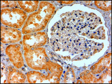 Anti-Adenosine A2B Receptor antibody produced in goat affinity isolated antibody, buffered aqueous solution