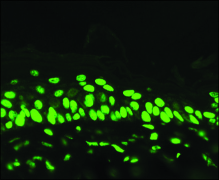 Monoclonal Anti-Acetylated Lysine antibody produced in mouse clone 7F8, 1&#160;mg/mL, purified immunoglobulin