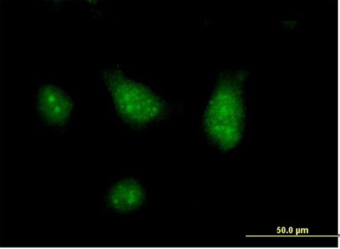 Anti-CISH antibody produced in mouse IgG fraction of antiserum, buffered aqueous solution