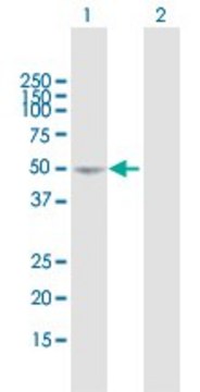 Anti-SEMA3D antibody produced in mouse purified immunoglobulin, buffered aqueous solution