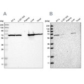 Anti-ACADVL antibody produced in rabbit Prestige Antibodies® Powered by Atlas Antibodies, affinity isolated antibody, buffered aqueous glycerol solution, Ab1