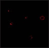 Anti-TCCR (ab1) antibody produced in rabbit affinity isolated antibody, buffered aqueous solution