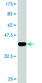 Monoclonal Anti-ILKAP, (C-terminal) antibody produced in mouse clone 3B5, purified immunoglobulin, buffered aqueous solution