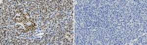 Anti-PDX1 Antibody, clone 1I16 ZooMAb® Rabbit Monoclonal recombinant, expressed in HEK 293 cells