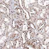 Anti-ZNF266 antibody produced in rabbit Prestige Antibodies® Powered by Atlas Antibodies, affinity isolated antibody, buffered aqueous glycerol solution