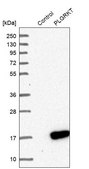 Anti-PLGRKT antibody produced in rabbit Ab1, Prestige Antibodies® Powered by Atlas Antibodies, affinity isolated antibody, buffered aqueous glycerol solution