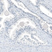 Monoclonal Anti-AGER antibody produced in mouse Prestige Antibodies® Powered by Atlas Antibodies, clone CL10587, purified antibody (Protein A)