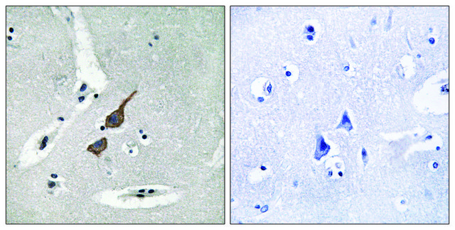 Anti-GRID1 antibody produced in rabbit affinity isolated antibody