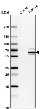 Anti-RNF149 antibody produced in rabbit Prestige Antibodies&#174; Powered by Atlas Antibodies, affinity isolated antibody, buffered aqueous glycerol solution