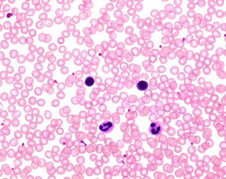 Hemacolor&#174; Rapid staining of blood smear Solution 2: colour reagent red