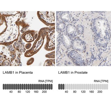 Anti-LAMB1 antibody produced in rabbit Ab2, Prestige Antibodies&#174; Powered by Atlas Antibodies, affinity isolated antibody, buffered aqueous glycerol solution