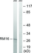 Anti-MRPL16 antibody produced in rabbit affinity isolated antibody