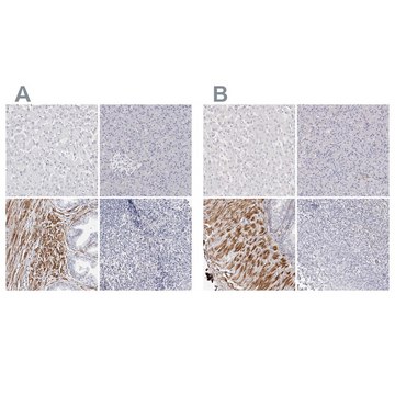 Anti-LMOD1 antibody produced in rabbit Prestige Antibodies&#174; Powered by Atlas Antibodies, affinity isolated antibody, buffered aqueous glycerol solution, ab3