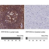 Anti-PPP1R18 antibody produced in rabbit Prestige Antibodies® Powered by Atlas Antibodies, affinity isolated antibody, buffered aqueous glycerol solution