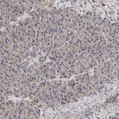 Anti-CANT1 antibody produced in rabbit Prestige Antibodies® Powered by Atlas Antibodies, affinity isolated antibody, buffered aqueous glycerol solution, Ab3