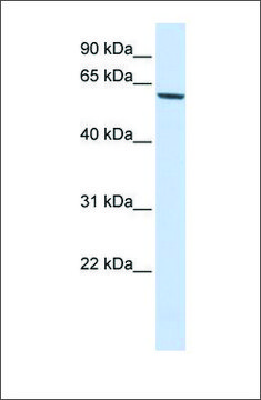 Anti-FOXO4 antibody produced in rabbit affinity isolated antibody