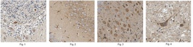 Anti-Mu Opioid Receptor Antibody from rabbit, purified by affinity chromatography