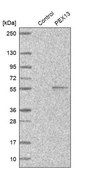 Anti-PEX13 antibody produced in rabbit Prestige Antibodies® Powered by Atlas Antibodies, affinity isolated antibody, buffered aqueous glycerol solution