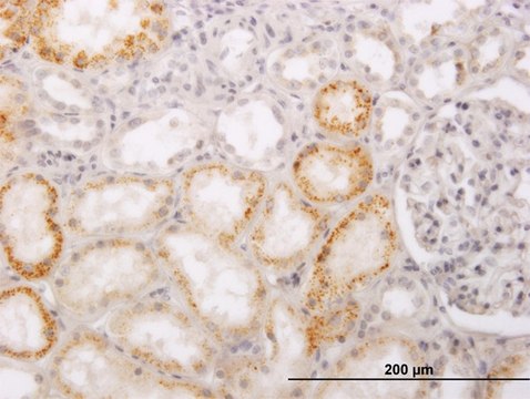 Monoclonal Anti-PHACS antibody produced in mouse clone 1D2, purified immunoglobulin, buffered aqueous solution