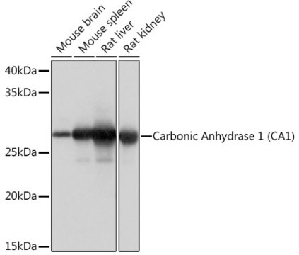 Anti-Carbonic Anhydrase 1 (CA1) Antibody, clone 0G10F8, Rabbit Monoclonal