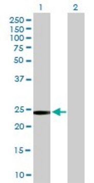 Anti-GSTT2 antibody produced in mouse purified immunoglobulin, buffered aqueous solution