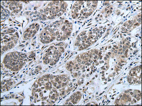 Anti-IWS1 affinity isolated antibody