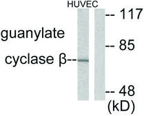 Anti-Guanylate Cyclase β antibody produced in rabbit affinity isolated antibody