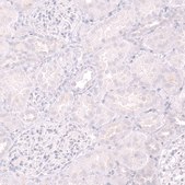 Monoclonal Anti-CD19 antibody produced in mouse Prestige Antibodies® Powered by Atlas Antibodies, clone CL15454, purified antibody (Protein A)