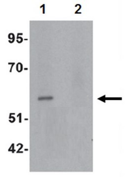 Anti-ESRRB Antibody from rabbit, purified by affinity chromatography