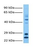 Anti-LYCAT affinity isolated antibody