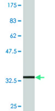 Monoclonal Anti-SLC36A2 antibody produced in mouse clone 2H3, purified immunoglobulin, buffered aqueous solution