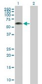 Anti-RP1-21O18.1 antibody produced in mouse IgG fraction of antiserum, buffered aqueous solution