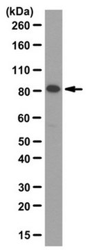 Anti-Lnk/SH2B adapter protein 3 Antibody from rabbit, purified by affinity chromatography