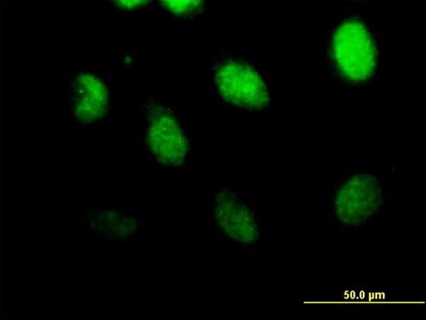 Anti-CSPG6 antibody produced in mouse purified immunoglobulin, buffered aqueous solution