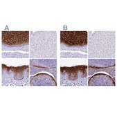 Anti-A2ML1 antibody produced in rabbit Prestige Antibodies® Powered by Atlas Antibodies, affinity isolated antibody, buffered aqueous glycerol solution