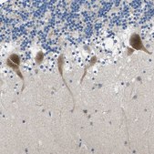 Anti-ERGIC3 antibody produced in rabbit Prestige Antibodies® Powered by Atlas Antibodies, affinity isolated antibody, buffered aqueous glycerol solution