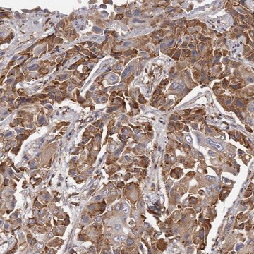 Anti-ALPK1 antibody produced in rabbit Prestige Antibodies&#174; Powered by Atlas Antibodies, affinity isolated antibody, buffered aqueous glycerol solution, ab1