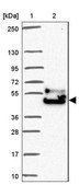 Anti-FAM149A antibody produced in rabbit Prestige Antibodies® Powered by Atlas Antibodies, affinity isolated antibody, buffered aqueous glycerol solution