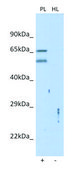 Anti-TMCC2 antibody produced in rabbit affinity isolated antibody