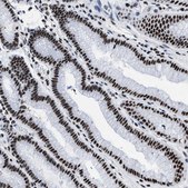 抗-SMARCC2 兔抗 affinity isolated antibody, buffered aqueous glycerol solution