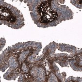 Monoclonal Anti-POSTN antibody produced in mouse Prestige Antibodies® Powered by Atlas Antibodies, clone CL12090, purified immunoglobulin, buffered aqueous glycerol solution