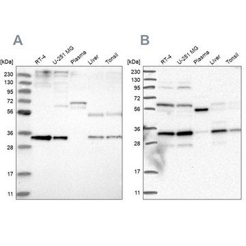 Anti-PPCS antibody produced in rabbit Prestige Antibodies&#174; Powered by Atlas Antibodies, affinity isolated antibody, buffered aqueous glycerol solution