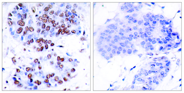 Anti-NF-&#954;B p65 antibody produced in rabbit affinity isolated antibody