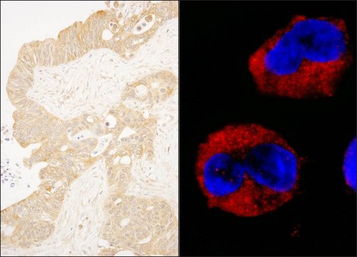 Rabbit anti-cAbl Antibody, Affinity Purified Powered by Bethyl Laboratories, Inc.