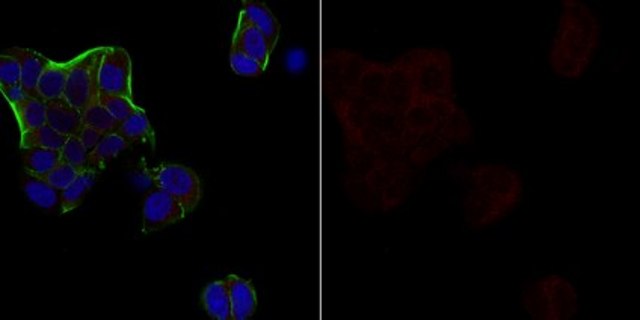 Anti-Androgen Receptor Antibody, Alexa Fluor&#8482; 647 Conjugate from rabbit, ALEXA FLUOR&#8482; 647