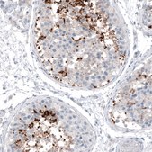 Monoclonal Anti-CT83 antibody produced in mouse Prestige Antibodies® Powered by Atlas Antibodies, clone CL4762, purified immunoglobulin